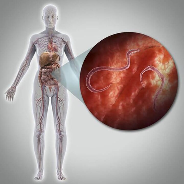 Parassiti nel corpo di una persona