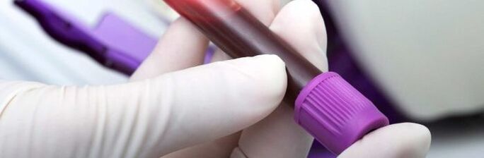 sangue per il test dei parassiti