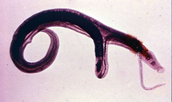 Gli schistosomi sono uno dei parassiti più comuni e pericolosi