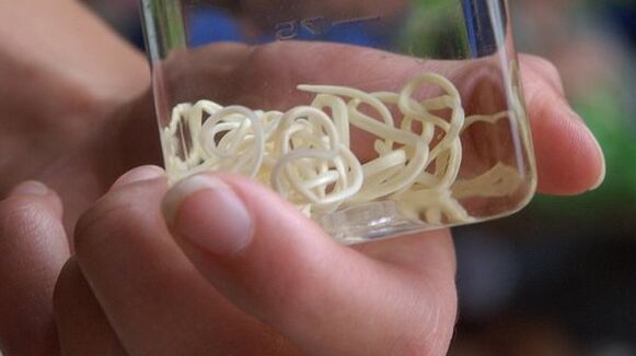 I vermi Filaria assomigliano in apparenza a un lungo filo