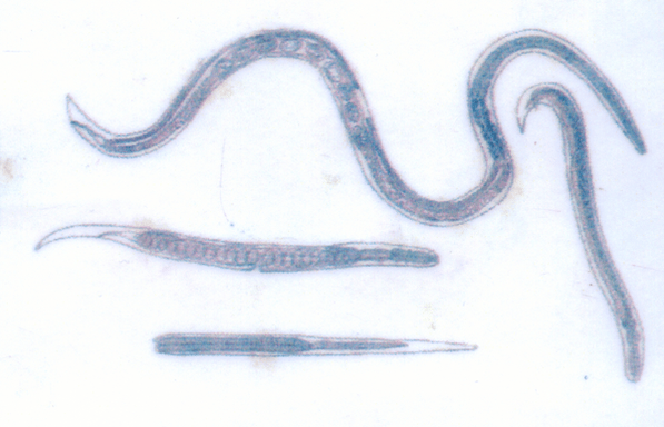 Il verme della Guinea, che parassita sotto la pelle, è facile da infettare